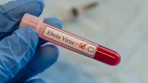 La OMS mantiene vigilancia internacional ante el avance del brote de ébola por la cepa Bundibugyo. / iStock