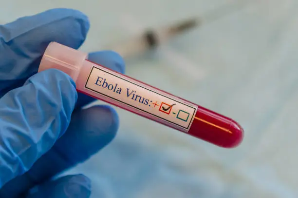 La OMS mantiene vigilancia internacional ante el avance del brote de ébola por la cepa Bundibugyo. / iStock