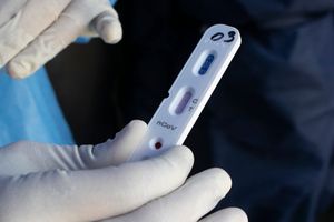 Vacuna contra el coronavirus podría estar disponible para agosto