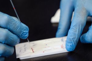 Monos infectados con Covid-19 desarrollaron inmunidad, reveló estudio