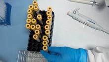 Coronavirus: Primeras pruebas de vacuna china dan resultados positivos