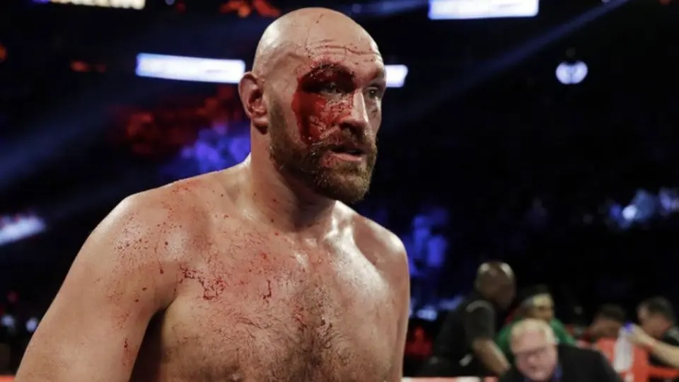 Tyson Fury no considera a Andy Ruz dentro de los cinco mejores boxeadores del mundo