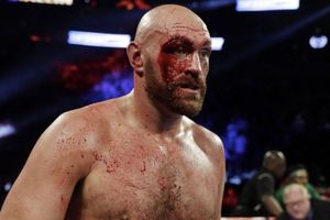 Tyson Fury no considera a Andy Ruz dentro de los cinco mejores boxeadores del mundo