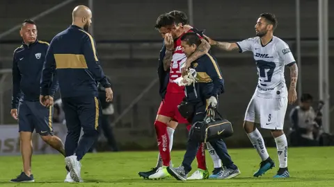 Miguel Fraga mostró sus heridas tras el choque en juego de Copa MX