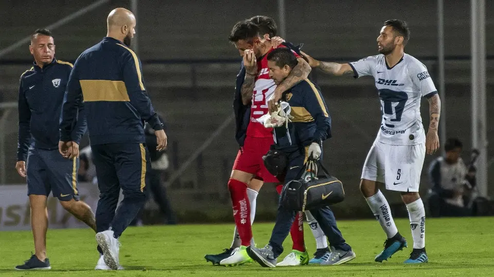 Miguel Fraga mostró sus heridas tras el choque en juego de Copa MX