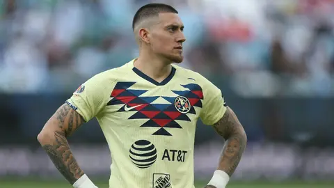 Nicolás Castillo presumió cicatriz tras operación y nuevo look en sus redes sociales