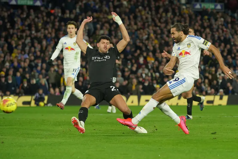 Calvert Lewin de Leeds intenta anotar en el partido contra Manchester City | AP