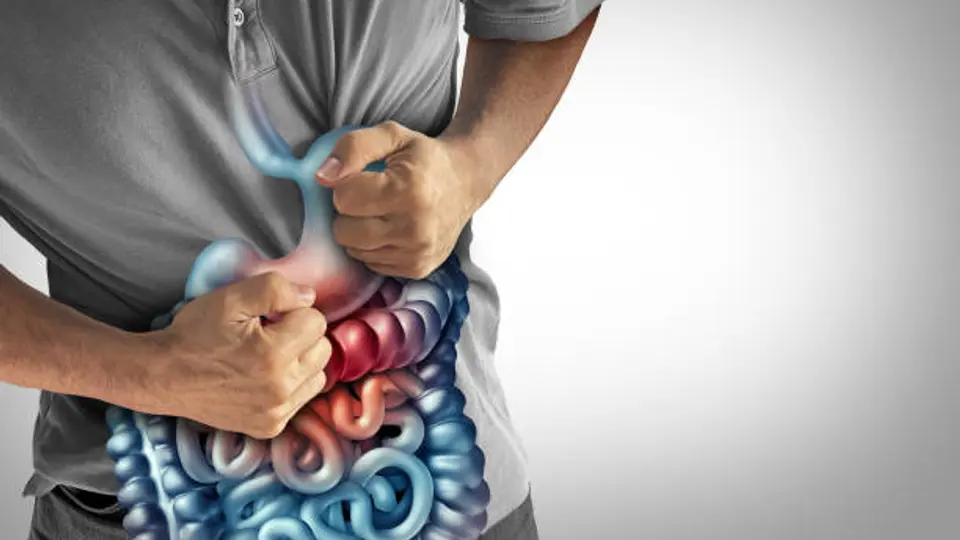 El Crohn es una enfermedad inflamatoria intestinal sin cura, pero con tratamiento. / iStock