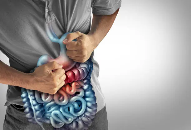 El Crohn es una enfermedad inflamatoria intestinal sin cura, pero con tratamiento. / iStock
