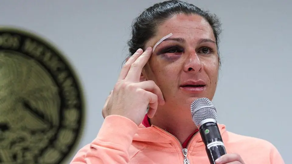 Ana Guevara identifica a presunto agresor