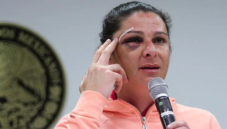 Ana Guevara identifica a presunto agresor
