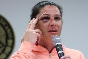 Ana Guevara identifica a presunto agresor