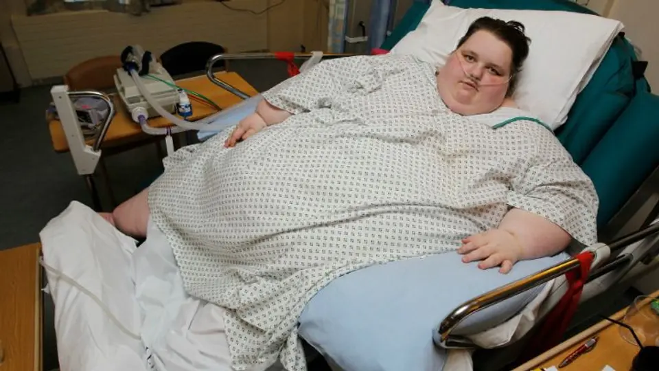 Mujer más obesa de Gales, 'cortada' tras bajar de peso