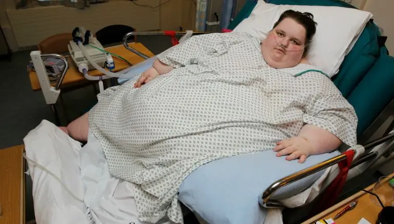 Mujer más obesa de Gales, 'cortada' tras bajar de peso