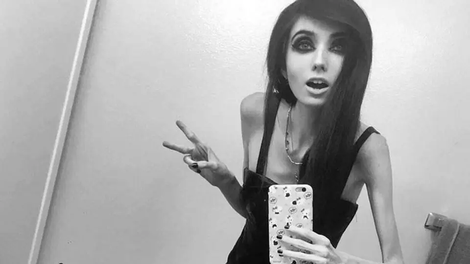 Youtuber perdería canal por 'inducir' a la anorexia