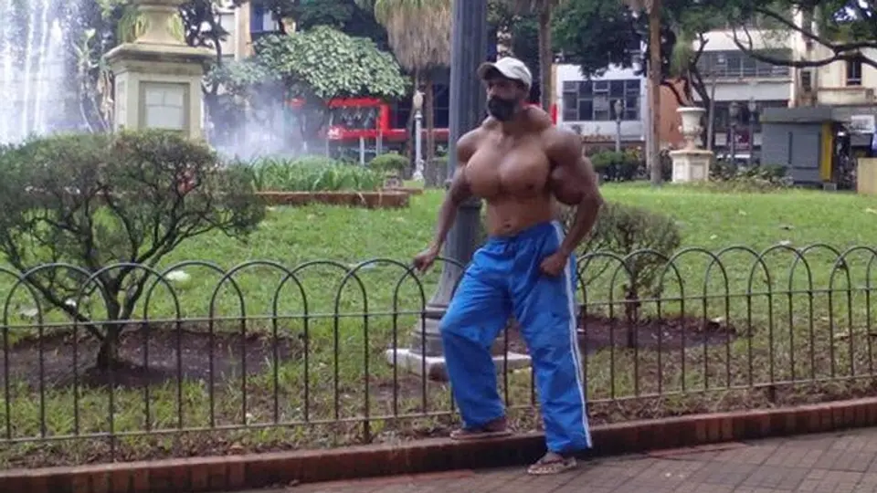 Hombre se inyecta aceite para romper 'récord de músculos'