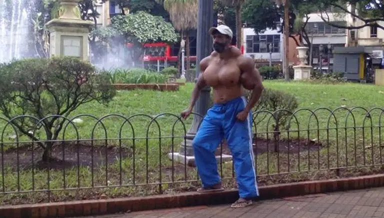 Hombre se inyecta aceite para romper 'récord de músculos'