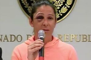 Elemento policiaco, probable implicado en golpiza a Ana Guevara