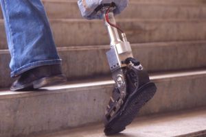 Hombre discapacitado es golpeado con su propia prótesis