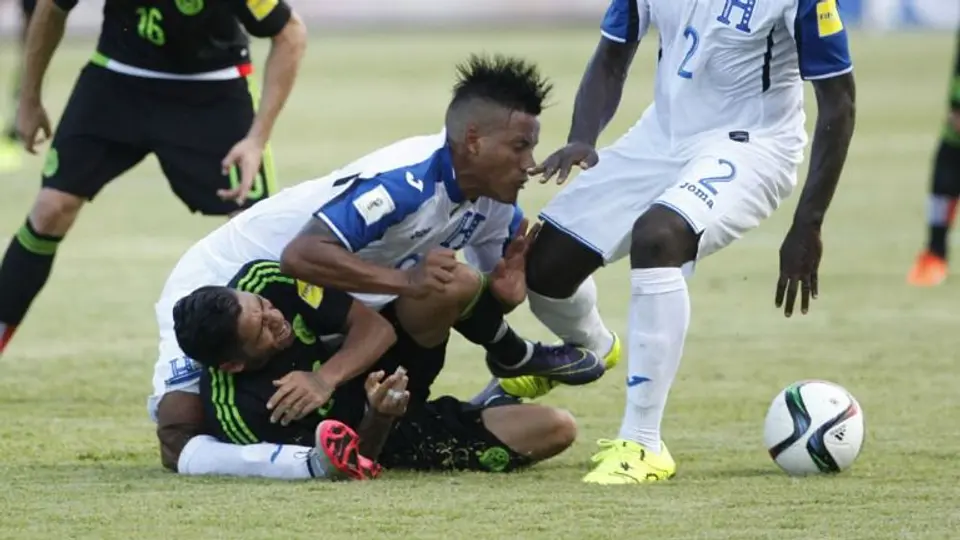 Lesiones deportivas que horrorizaron al mundo