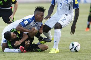 Lesiones deportivas que horrorizaron al mundo