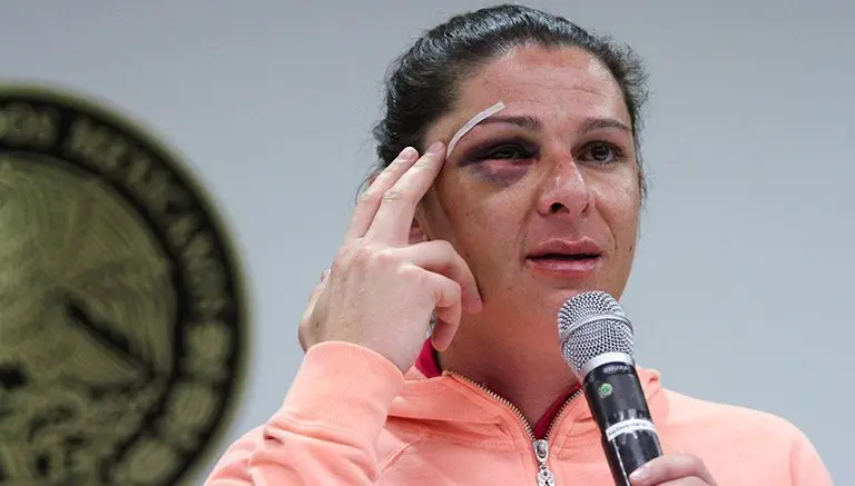 Guevara identifica camioneta en la que viajaban sus agresores