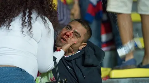 Seguidores de Cruz Azul y Monarcas protagonizan pelea en el Morelos