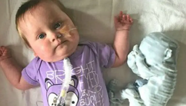 Bebé nace con el corazón fuera del cuerpo