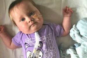 Bebé nace con el corazón fuera del cuerpo