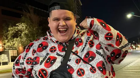 El influencer Baby Face encendió las alarmas al compartir que estaba hospitalizado/IG: @oscarbabyface