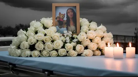 El caso de Nicole sirvió para poder regular operaciones estéticas en menores de edad / Especial