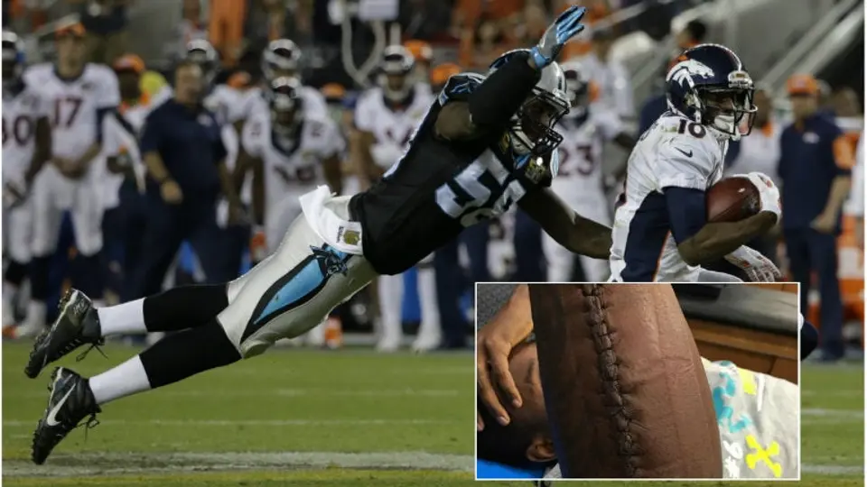 Jugador de Panteras muestra escalofriante cicatriz tras SB 50
