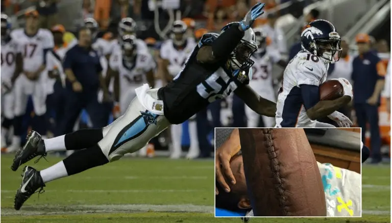Jugador de Panteras muestra escalofriante cicatriz tras SB 50