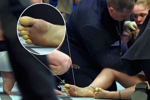 Pies de Ronda revelarían causa de su derrota