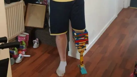 Joven fabrica una 'pierna de Lego' para concientizar sobre la diabetes