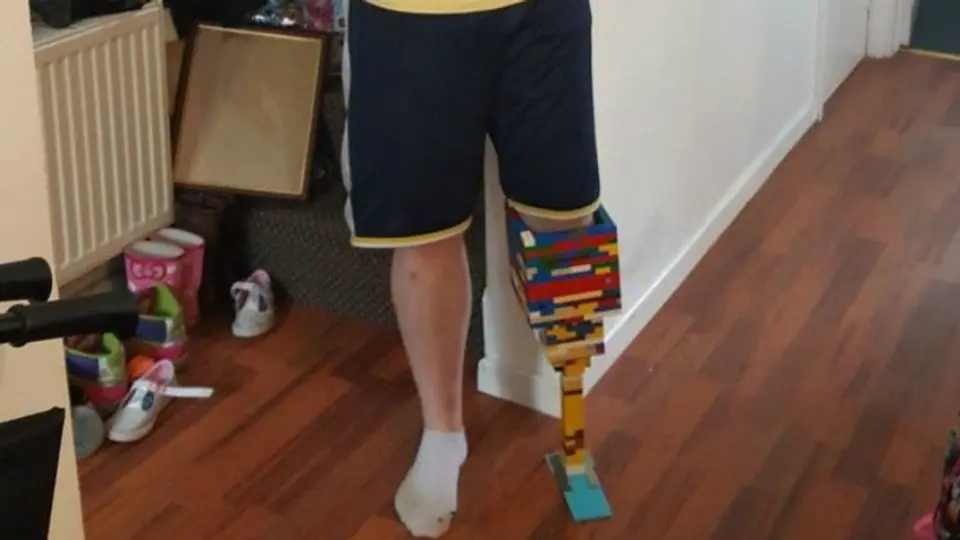 Joven fabrica una 'pierna de Lego' para concientizar sobre la diabetes