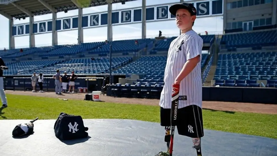 Yanquis 'contrata' a niño sin manos