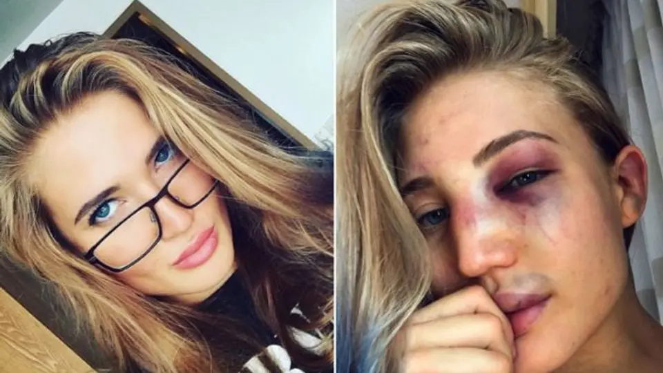 Sexy peleadora de MMA presume en redes su rostro golpeado