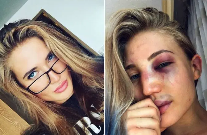 Sexy peleadora de MMA presume en redes su rostro golpeado