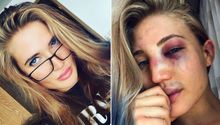Sexy peleadora de MMA presume en redes su rostro golpeado