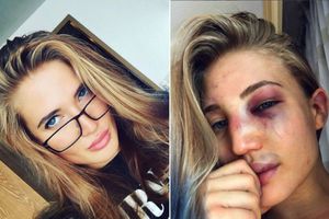 Sexy peleadora de MMA presume en redes su rostro golpeado