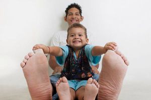 Hombre con pie de 40 cm entra a los Récord Guinness