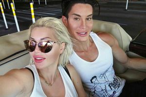 'Ken y Barbie', flechados por el amor a cirugías