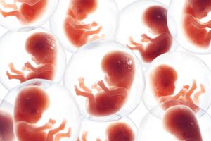 Pareja demanda a clínica tras descubrir que el embrión implantado no era el suyo