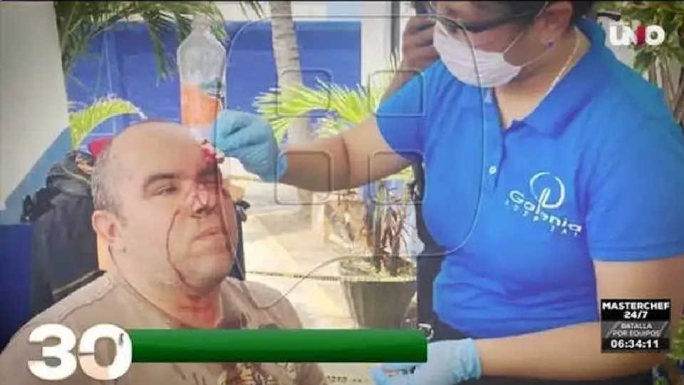 A parte de los golpes que recibió, su equipo de trabajo quedó dañado / Especial