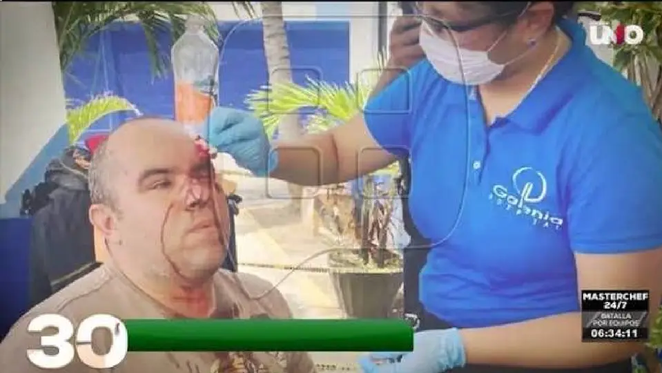 A parte de los golpes que recibió, su equipo de trabajo quedó dañado / Especial