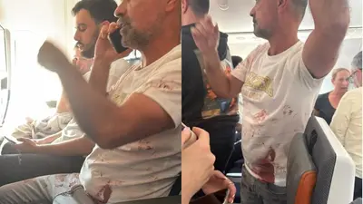 PRIMERAS IMÁGENES: pasajero ensangrentado tras emergencia en avión con rumbo a Israel
