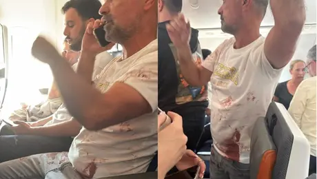 PRIMERAS IMÁGENES: pasajero ensangrentado tras emergencia en avión con rumbo a Israel