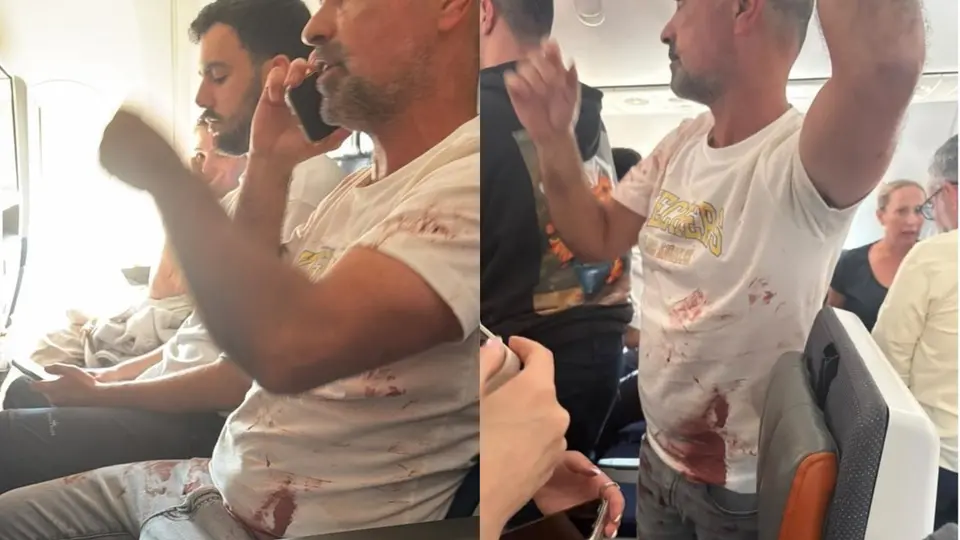 PRIMERAS IMÁGENES: pasajero ensangrentado tras emergencia en avión con rumbo a Israel