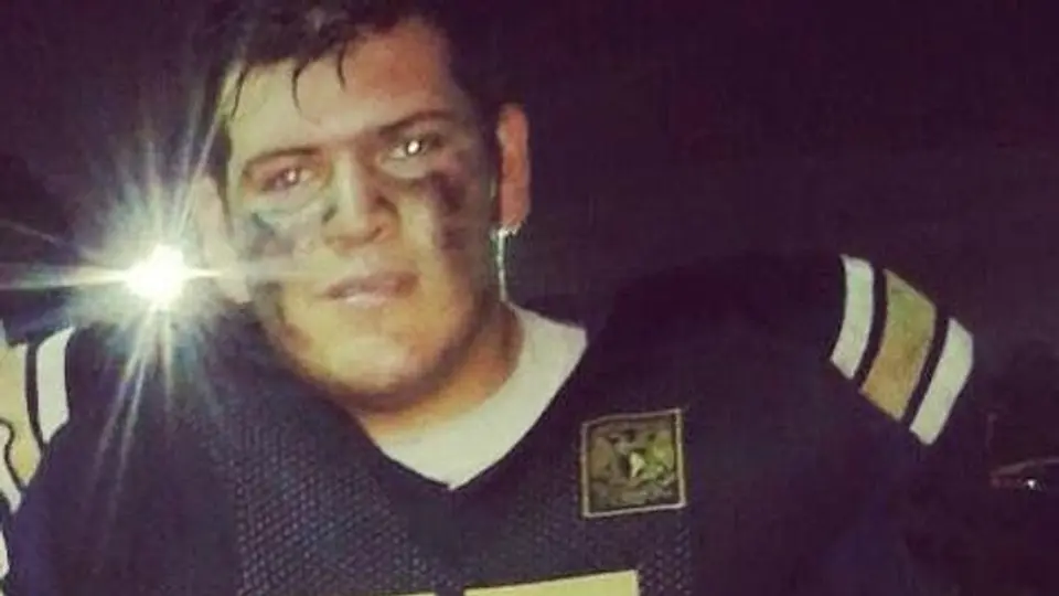 Jugador de Pumas CU, a terapia intensiva tras 'novatada'